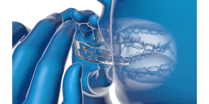 51fe2117920d4b0731d6e31db0a58d94_1741586348_311.gif