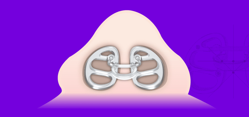 51fe2117920d4b0731d6e31db0a58d94_1741594842_661.gif